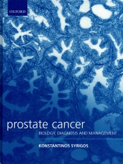 PROSTATE CANCER: BIOLOGY, DIAGNOSIS AND MANAGEMENT